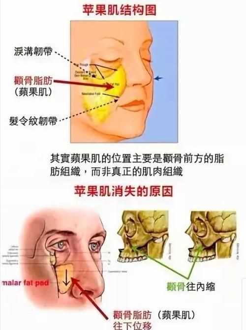 顴骨是指五官的哪個(gè)地方圖片