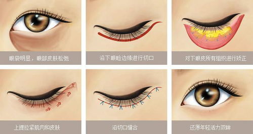貴陽(yáng)整形有哪些方法有哪些方法有哪些