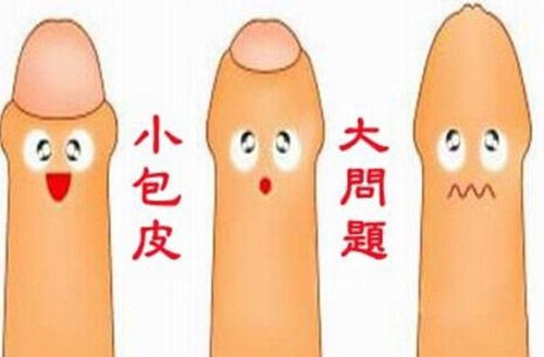 注意事項,有哪些,割包皮