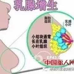 小葉增生的注意事項,雙乳小葉增生怎么辦,要注意些什么,小葉增生術(shù)后注意事項