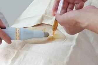 刃針療法后的注意事項,做完浮針療法后注意事項,小寬針療法后注意事項