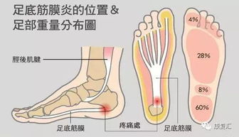 腰背肌筋膜炎注意事項