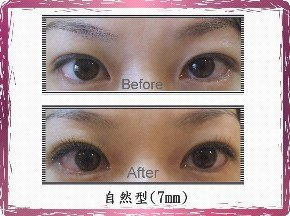睫毛,注意事項