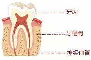 牙槽骨切除術(shù)注意事項