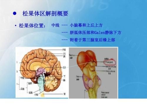 松果體囊腫注意事項,兒童松果體鈣化,松果體腫瘤飲食注意事項