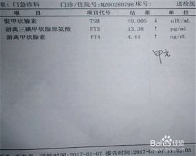 注意事項,檢查