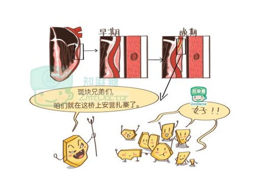 冠心病的注意事項有哪些,冠心病的注意事項有哪些健康一線(xiàn),冠心病的注意事項有哪些五個(gè)