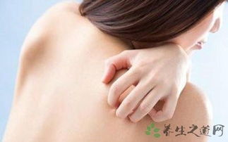 蕁麻疹,注意事項,冷激性
