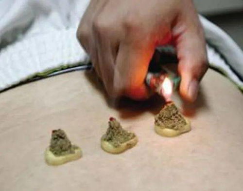隔姜灸的操作方法和注意事項,隔姜灸的禁忌癥和注意事項,隔姜灸的目的及注意事項