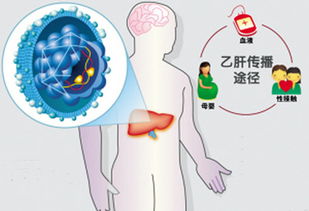做乙肝dna前注意事項