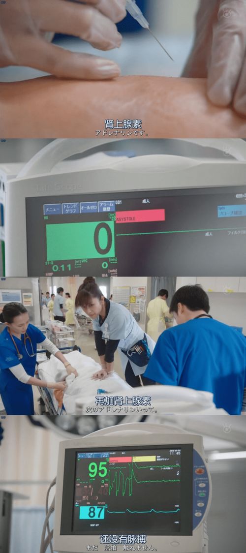 過(guò)敏性休克腎上腺素使用注意事項