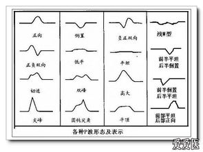 心電圖基礎知識本科生講座