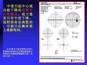 光學(xué)檢測類(lèi)基礎知識